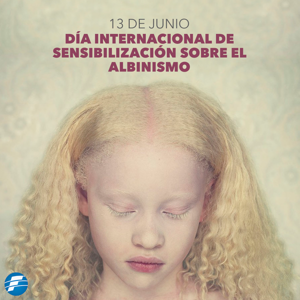 Día Internacional de sensibilización sobre el albinismo